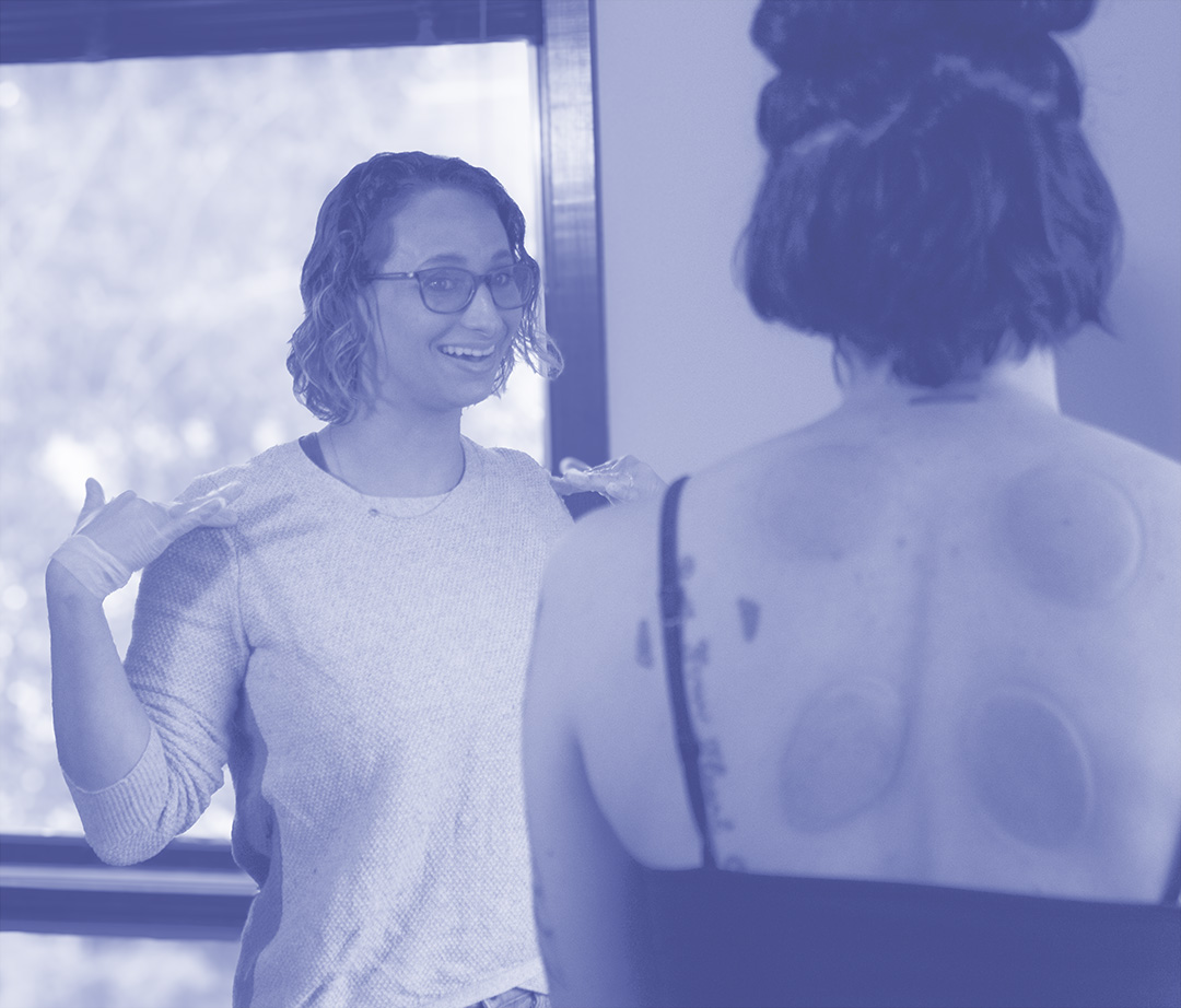 Jenna working with a patient during cupping therapy